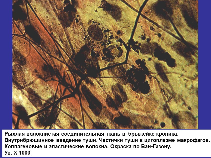 Рыхлая волокнистая соединительная ткань в  брыжейке кролика. Внутрибрюшинное введение туши. Частички туши в